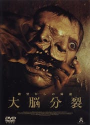 大脳分裂
