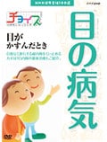チョイス@病気になったとき 目がかすんだとき