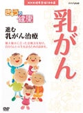 きょうの健康 進む 乳がん治療